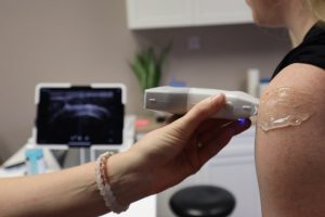 肩周炎：病理解析與臨床管理策略